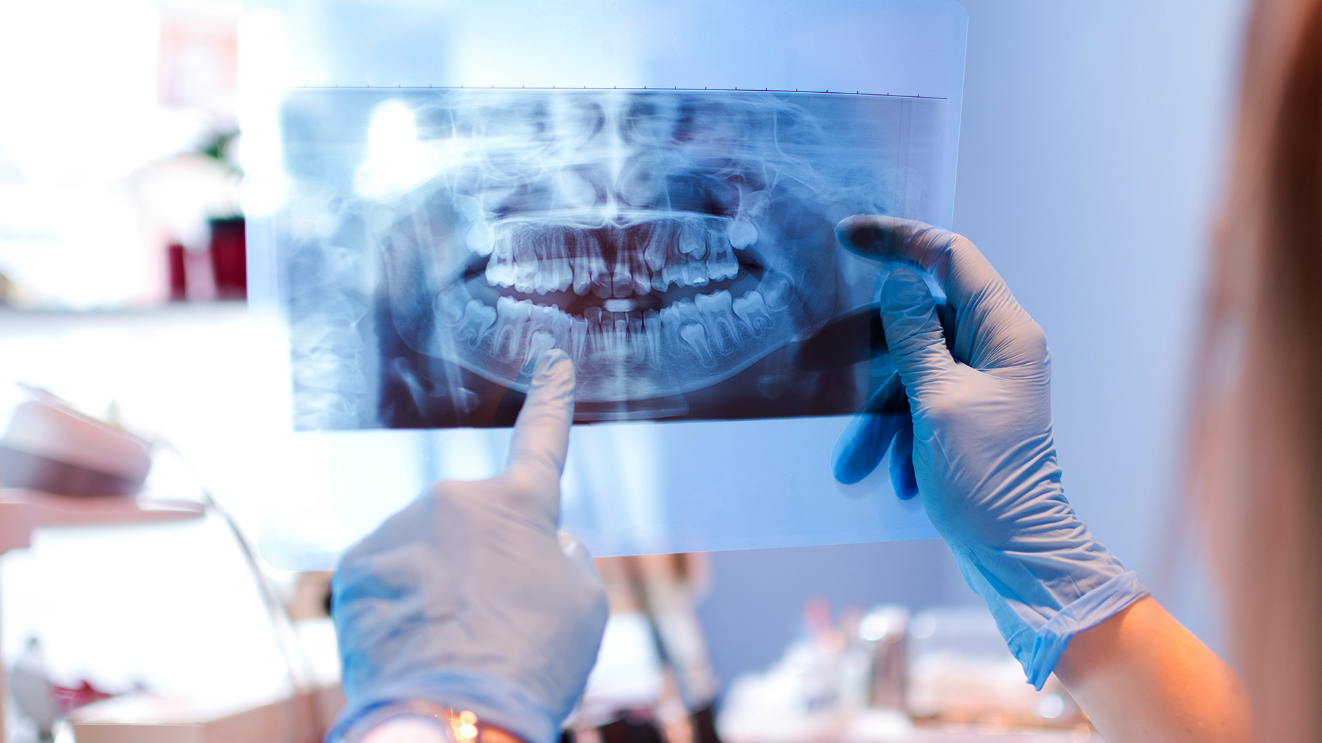 A dental professional wearing gloves closely examines a 3D printed model of a person s teeth and mouth.