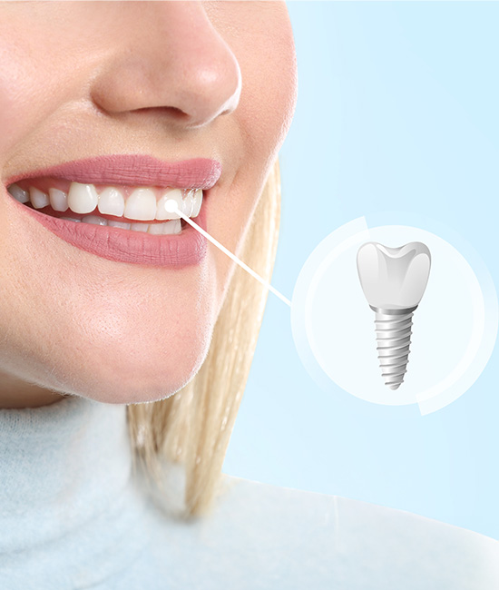 The image shows a close-up of a person s face with a smile, displaying a toothbrush with an attached toothpick, emphasizing dental hygiene.