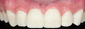 dental images 11565