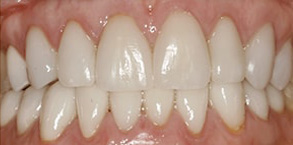 dental images in Malverne