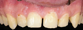 dental images in Malverne