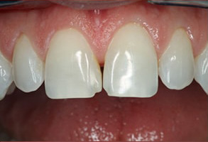 dental images 11565